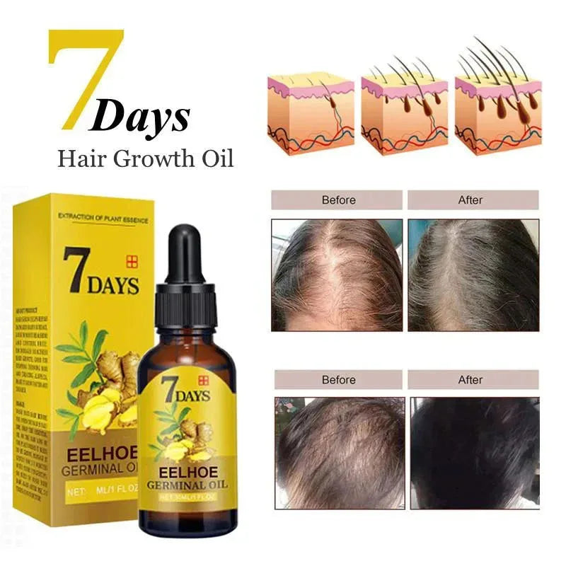 7 Days Fast Ginger Hair Growth Serum Anti-loss Hair Regrowth Essential