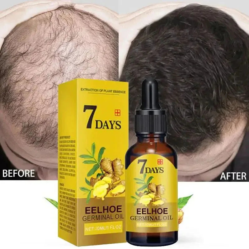 7 Days Fast Ginger Hair Growth Serum Anti-loss Hair Regrowth Essential